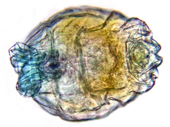A microscopic aquatic animal known as a rotifer, shown under the microscope.